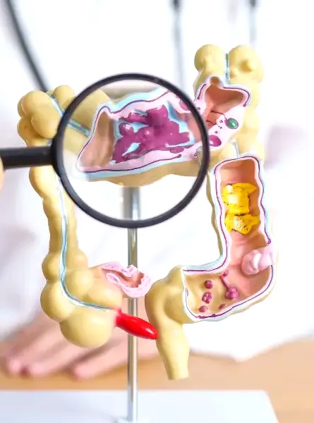a doctor holding a magnifying glass over a model of the human digestive system